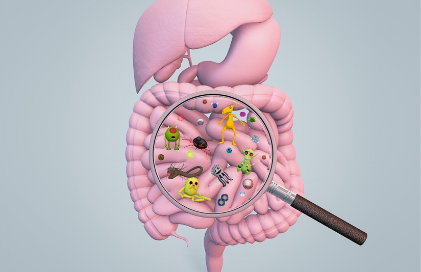 SIBO, Disbiosis, Sindrome de intestino permeable y Sindrome de intestino irritable
